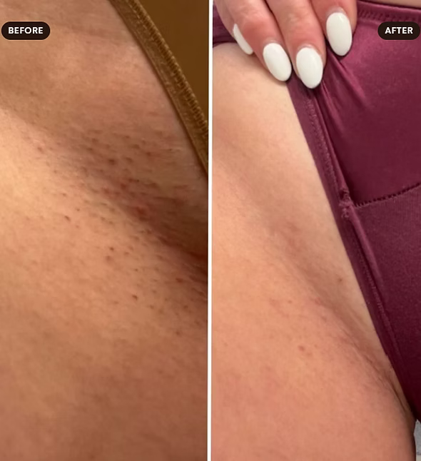 LumiShave™ - 2-in-1 Women´s Body Shaver